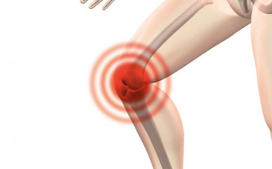 Das Knie, Thema bei Verständlicher Medizing